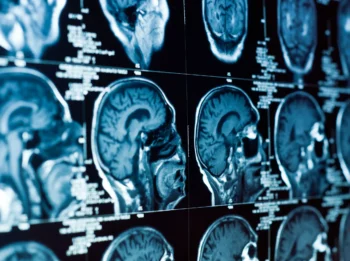 MRI Technologist